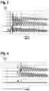 Fig. 03 - Determination of an interrupted motor phase of an electric motor