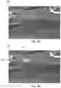 Fig. 07 - Pulse detection and synchronized pulse imaging systems and methods