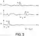Fig. 04 - System, method, and apparatus for synchronizing sensors for signal detection