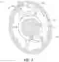 Fig. 06 - Headphone