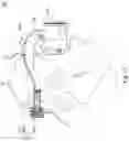 Fig. 12 - Headset electronic device and headband adjustment structure thereof