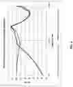 Fig. 05 - Audio device with audio signal processing based on acoustic valve state