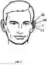 Fig. 02 - EXTERNAL EAR INSERT FOR HEARING ENHANCEMENT