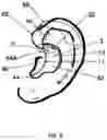 Fig. 05 - EXTERNAL EAR INSERT FOR HEARING ENHANCEMENT