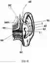 Fig. 06 - EXTERNAL EAR INSERT FOR HEARING ENHANCEMENT