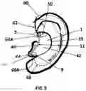 Fig. 07 - EXTERNAL EAR INSERT FOR HEARING ENHANCEMENT