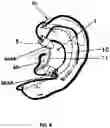 Fig. 08 - EXTERNAL EAR INSERT FOR HEARING ENHANCEMENT