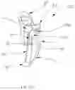 Fig. 14 - EXTERNAL EAR INSERT FOR HEARING ENHANCEMENT