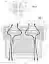 Fig. 07 - Acoustic valve for hearing device