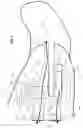 Fig. 08 - Acoustic valve for hearing device