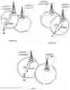 Fig. 04 - Methods and user equipment for recovering from issues of connectivity between a PLMN and a UE