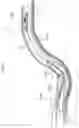 Fig. 08 - Component feeding device and method
