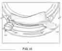 Fig. 12 - Shutter locking assembly for a lawnmower, lawnmower having same, and convertible lawnmower