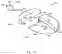 Fig. 102 - Insect trap device and method of using