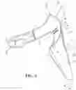 Fig. 04 - Arm warming device