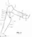 Fig. 06 - Arm warming device