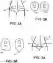 Fig. 03 - GARMENT FOR USE WITH STOMAS