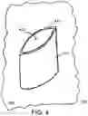 Fig. 04 - GARMENT FOR USE WITH STOMAS