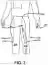 Fig. 04 - Medically Accessible Clothing