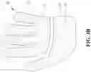 Fig. 05 - Protective Glove for Athletes