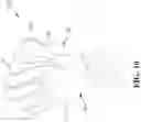 Fig. 12 - Protective Glove for Athletes