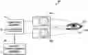 Fig. 01 - Methods for fabricating custom eyelash prostheses