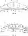 Fig. 05 - Footwear arch support