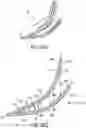 Fig. 10 - Footwear arch support