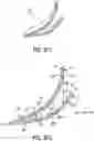 Fig. 12 - Footwear arch support