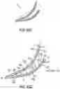 Fig. 13 - Footwear arch support