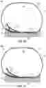 Fig. 22 - Footwear arch support