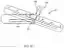 Fig. 52 - Rapid-entry shoe