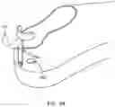 Fig. 55 - Rapid-entry shoe