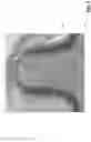 Fig. 08 - CURVED, BONDED FASTENING ELEMENT