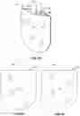 Fig. 22 - Hand-held applicator