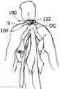 Fig. 01 - OUTER GARMENT CARRIER