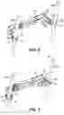 Fig. 07 - Adjustable chair support system