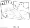 Fig. 03 - Bed sheet fastener