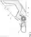 Fig. 03 - Surface cleaning apparatus
