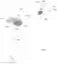 Fig. 08 - Ophthalmic microscope and functionality enhancement unit