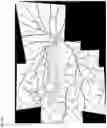 Fig. 08 - Ophthalmological device, ophthalmological image processing method, and storage medium