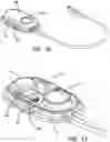 Fig. 13 - Skull-mounted drug and pressure sensor