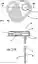 Fig. 17 - Skull-mounted drug and pressure sensor
