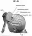 Fig. 11 - Method and program for navigating TMS stimulation