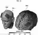 Fig. 18 - Method and program for navigating TMS stimulation