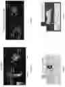 Fig. 11 - Systems, methods, and apparatus for multichannel imaging of fluorescent sources in real-time