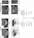 Fig. 13 - Systems, methods, and apparatus for multichannel imaging of fluorescent sources in real-time