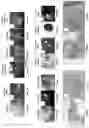 Fig. 14 - Systems, methods, and apparatus for multichannel imaging of fluorescent sources in real-time