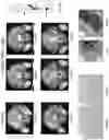 Fig. 15 - Systems, methods, and apparatus for multichannel imaging of fluorescent sources in real-time