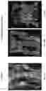 Fig. 16 - Systems, methods, and apparatus for multichannel imaging of fluorescent sources in real-time